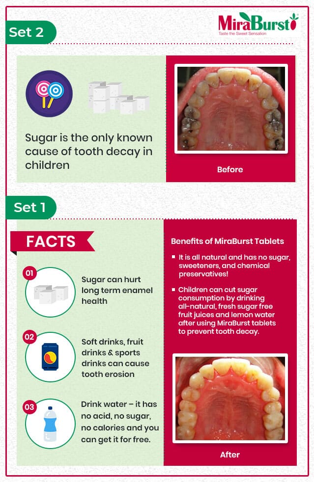 set 2 and set 1 infographic about cavities